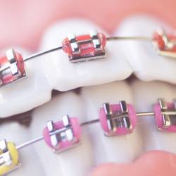 Best dentist in Gorakhpur, Dentist in Gorakhpur, Dental Hospital in Gorakhpur, Dental clinic in Gorakhpur, Esthetic dentist in Gorakhpur, Best dental surgeon in Gorakhpur, Dental Implants Doctors in Gorakhpur, Best dental clinic in Gorakhpur